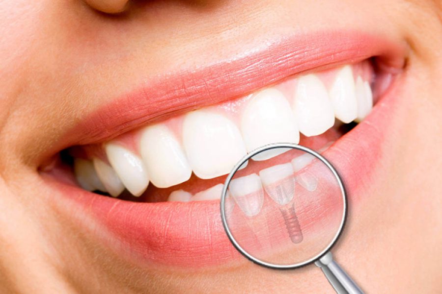 Blog Dentista | Artículo De Salud Oral | Cuidado De Los Dientes | Clara ...